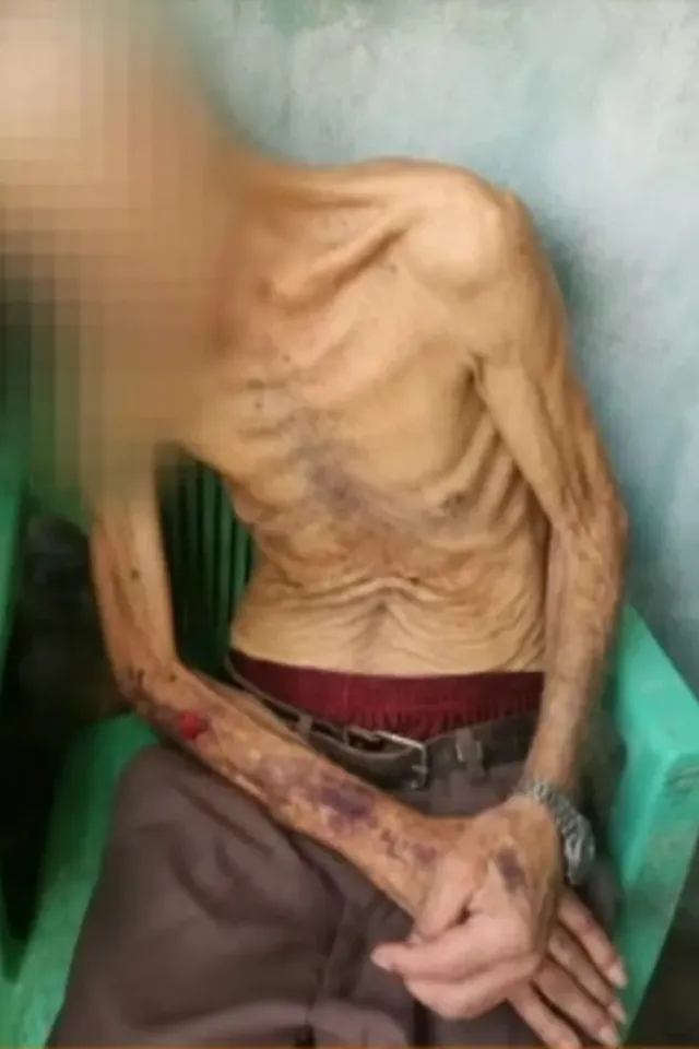 Filho é preso por maus-tratos contra pai de 80 anos em São Miguel dos Campos