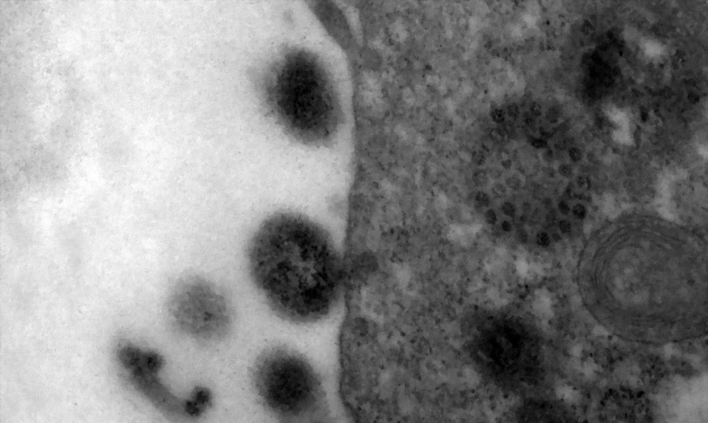 Partículas infectivas deixam o interior da célula em direção a outra célula saudável dando continuidade ao ciclo de infecção. Registro do momento exato em que uma célula é infectada pelo novo coronavírus, obtido durante estudo que investiga a replicação v